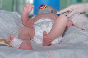 Medical malpractice lawyer birth injury arizona